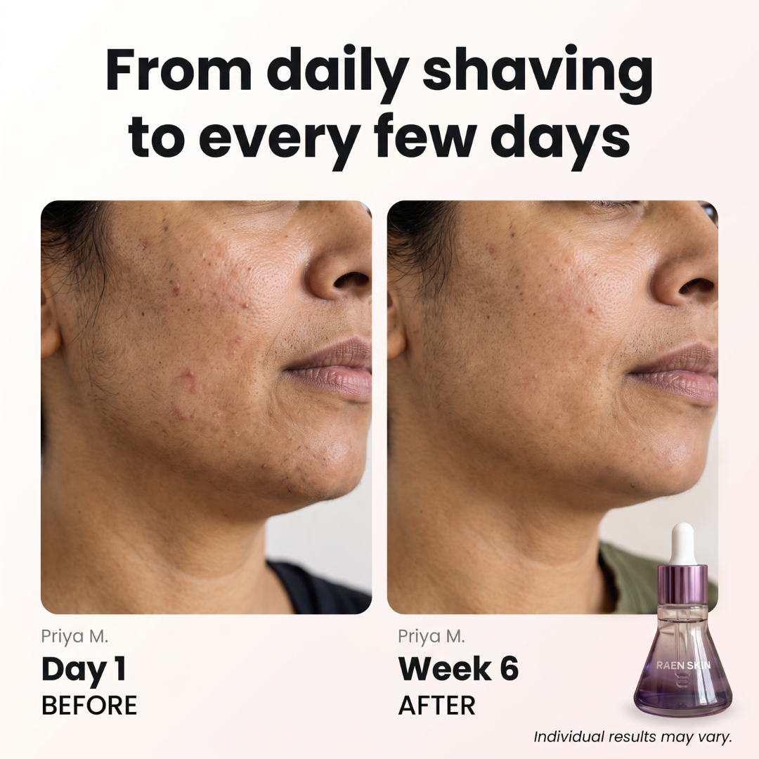 Raen Regrowth Control Serum™