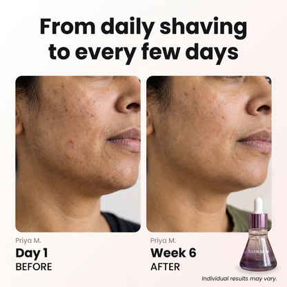 Raen Regrowth Control Serum™
