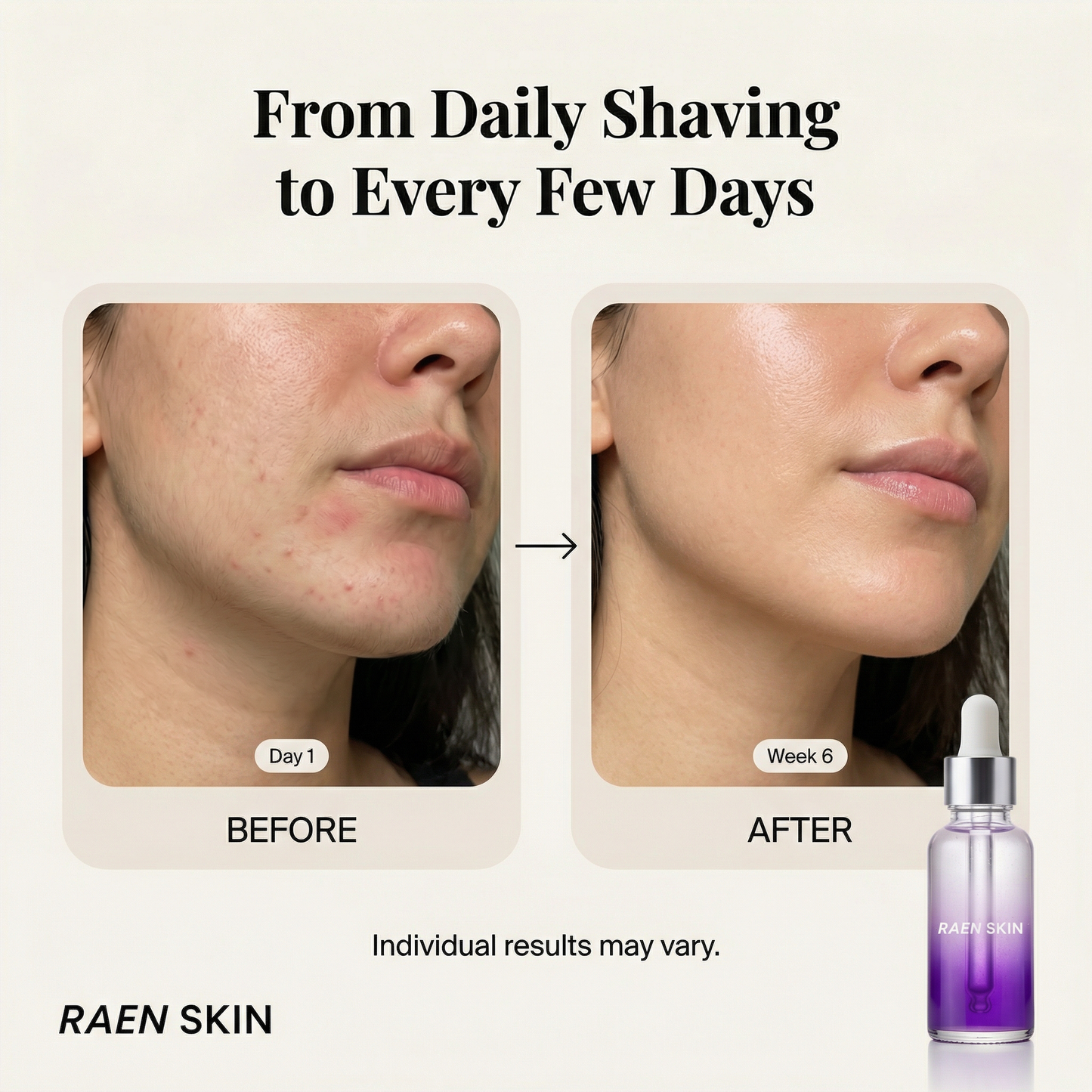 Raen Regrowth Control Serum™