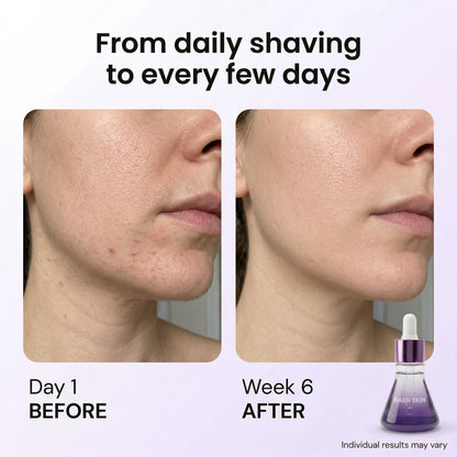 Raen Regrowth Control Serum™